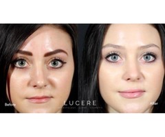 Dermatologist for Skin Tightening | free-classifieds-canada.com - 1
