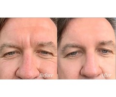Anti-Aging Beauty Products - All Natural | free-classifieds-canada.com - 1