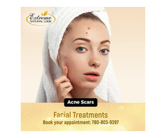 Deep Facial Cleansing - Extreme Natural Look | free-classifieds-canada.com - 2