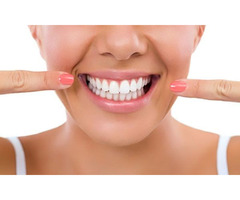 Teeth Whitening Vs. Dental Veneers: What Plessis Suggests? | free-classifieds-canada.com - 1
