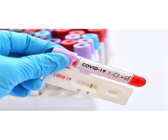 COVID Antigen & Antibody Testing - Travel Clinic Calgary | free-classifieds-canada.com - 2