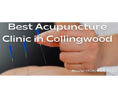 Collingwood Acupuncture Clinic - Georgian Bay Integrative Medicine | free-classifieds-canada.com - 1