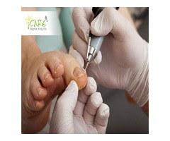 Best Foot Care Services for Seniors by iCare Home Health | free-classifieds-canada.com - 1