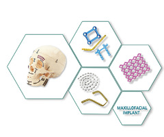 Maxillofacial implants Manufacturers in Canada | free-classifieds-canada.com - 1
