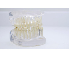 Dental Implants | free-classifieds-canada.com - 1