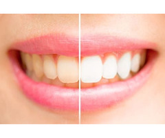 Natural Teeth Whitener | free-classifieds-canada.com - 2