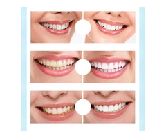 Natural Teeth Whitener | free-classifieds-canada.com - 3