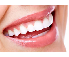 Natural Teeth Whitener | free-classifieds-canada.com - 4