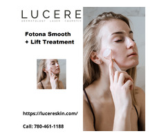 Fotona Smooth + Lift Treatment Edmonton - LucereSkin | free-classifieds-canada.com - 1