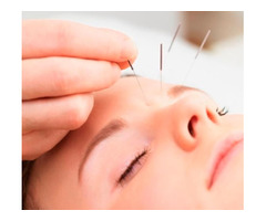 Get the Excellent Acupuncture Treatment in Toronto  | free-classifieds-canada.com - 1