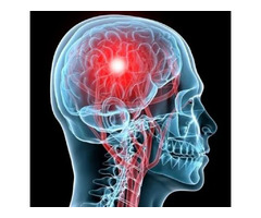 Professional Concussion Treatment in Camrose | free-classifieds-canada.com - 1