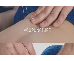 Chinese Acupuncture Treatment in Brampton | free-classifieds-canada.com - 1