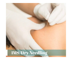 Treatment of IMS/dry needling | free-classifieds-canada.com - 1