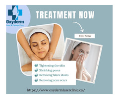 Best facial clinic in Edmonton | Laser Clinic for Skin Tightening | Oxyderm clinic | free-classifieds-canada.com - 1