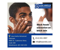 Cell Renewal Oxygen Treatment | Lisaanella | free-classifieds-canada.com - 1