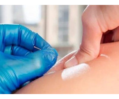 Needle Away Pain: IMS/Dry Needling Therapy for Instant Relief! | free-classifieds-canada.com - 1