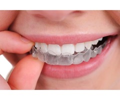 Reliable Dental Mouth Guard | free-classifieds-canada.com - 1