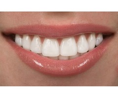 Cosmetic Dentistry Service in Brampton | free-classifieds-canada.com - 1