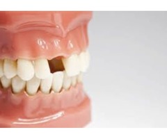 holistic dentist | free-classifieds-canada.com - 3